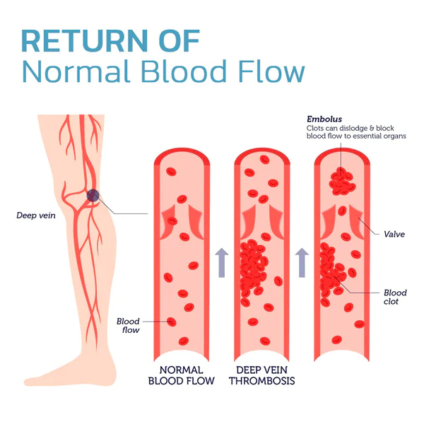 Calcetines Elásticos Moldeadores de Cuerpo Iónico de Turmalina Fivfivgo™